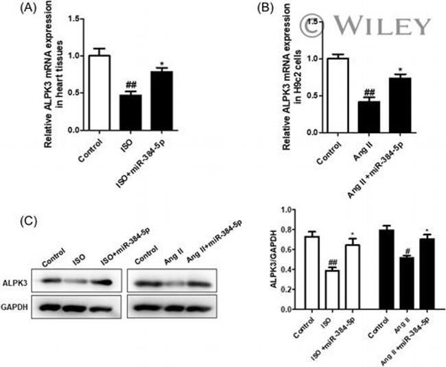 ALPK3 Antibody in Western Blot (WB)