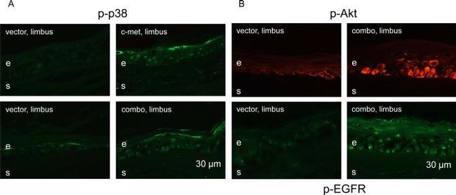 Phospho-EGFR (Tyr845) Antibody in Immunohistochemistry (IHC)