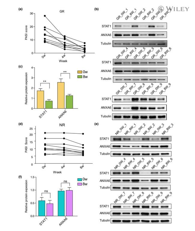 Annexin A6 Antibody in Western Blot (WB)