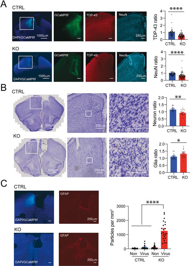 GFAP Antibody in Immunohistochemistry (IHC)