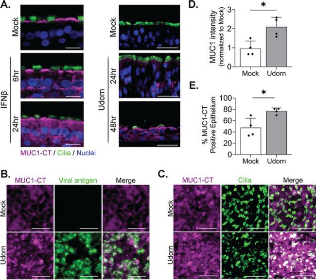 MUC1 Antibody in Immunocytochemistry (ICC/IF)