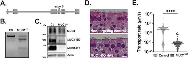 MUC1 Antibody in Western Blot (WB)