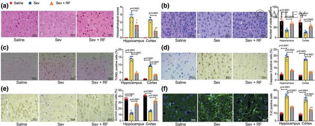 Survivin Antibody in Immunohistochemistry (IHC)