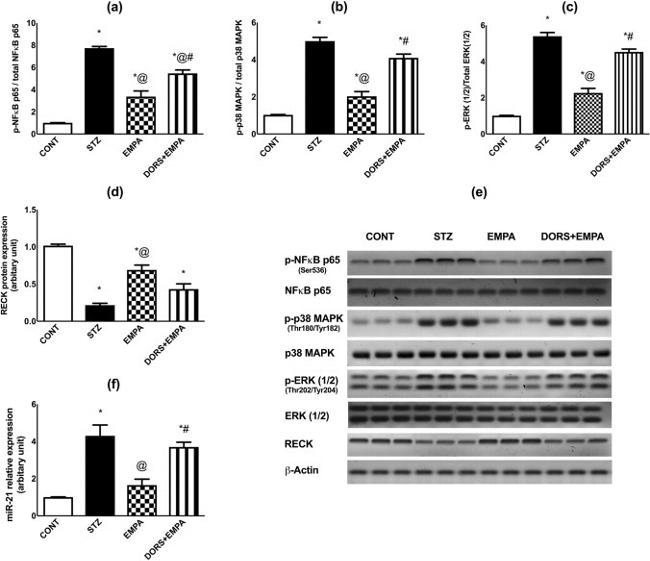 p38 MAPK Antibody in Western Blot (WB)