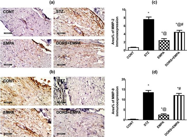 MMP2 Antibody in Immunohistochemistry (IHC)