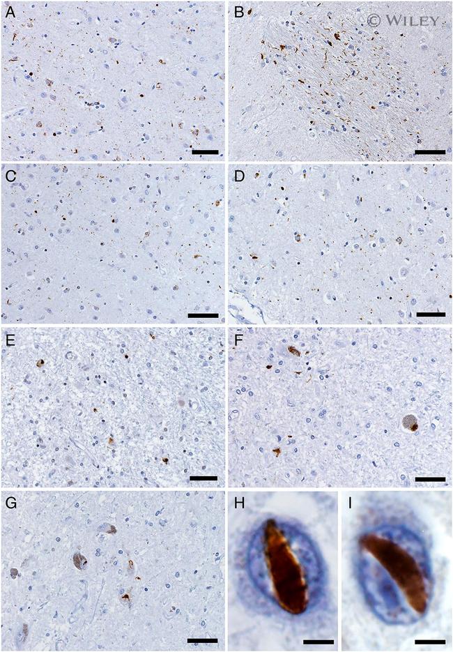 VCP Antibody in Immunohistochemistry (IHC)