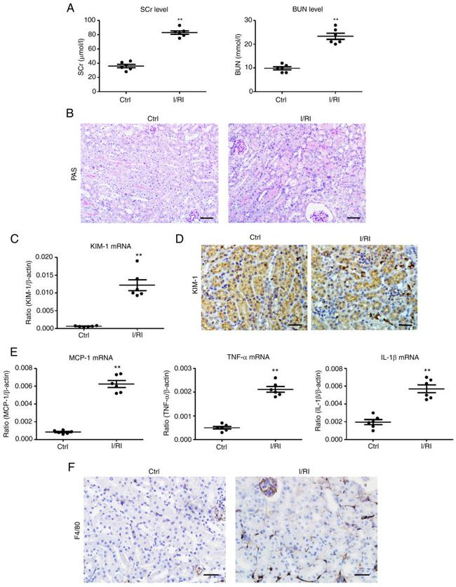 CD365 (TIM1) Antibody in Immunohistochemistry (IHC)