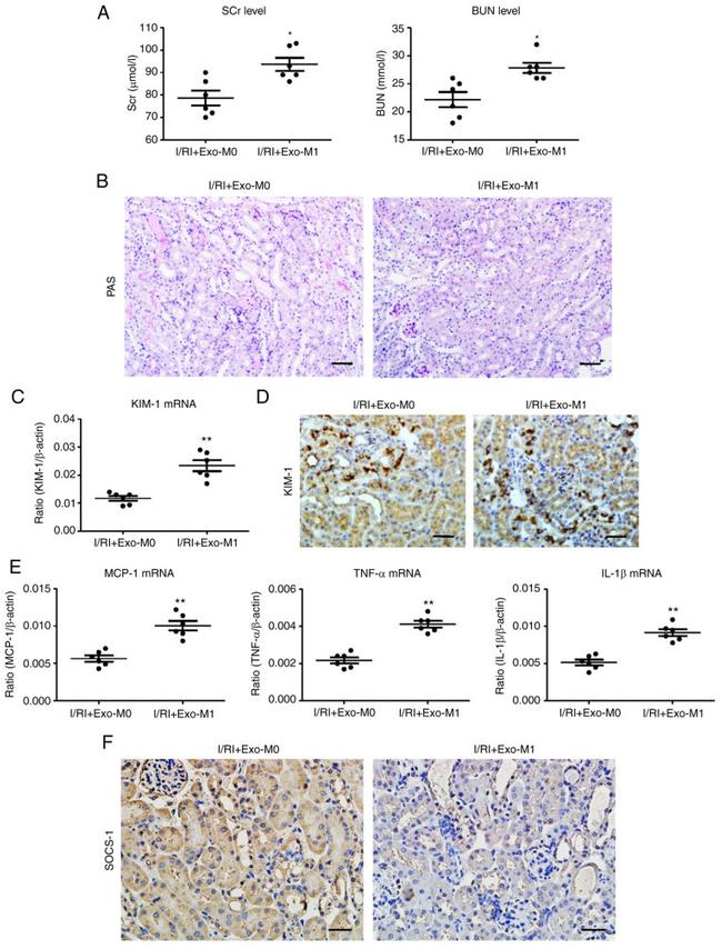 CD365 (TIM1) Antibody in Immunohistochemistry (IHC)