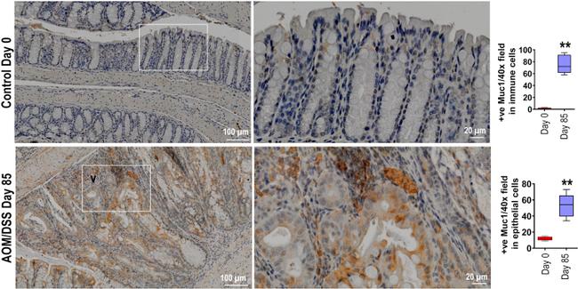 MUC1 Antibody in Immunohistochemistry (IHC)