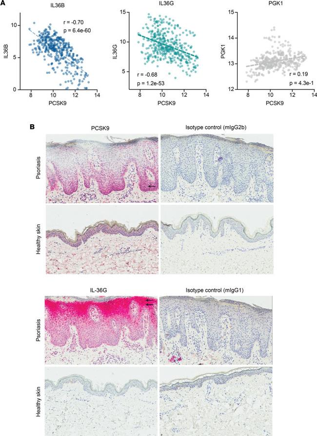 PCSK9 Antibody in Immunohistochemistry (IHC)