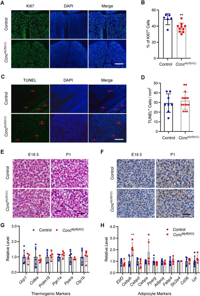 UCP1 Antibody in Immunohistochemistry (IHC)