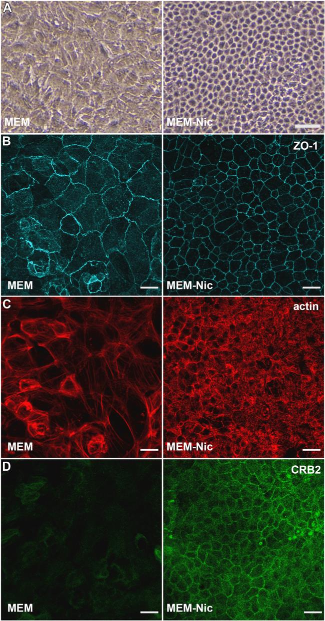 CRB2 Antibody in Immunocytochemistry (ICC/IF)