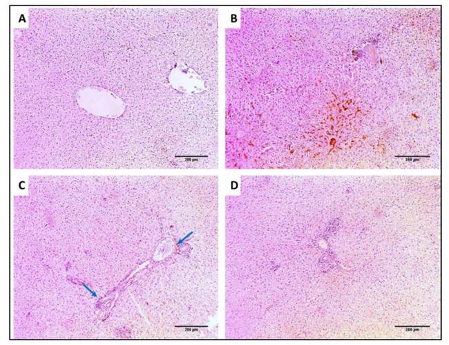 TNF alpha Antibody in Immunohistochemistry (IHC)