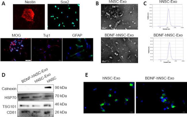 TSG101 Antibody in Western Blot (WB)