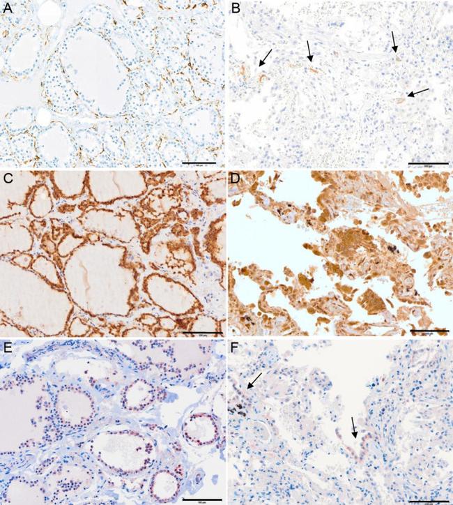 ACE2 Antibody in Immunohistochemistry (IHC)