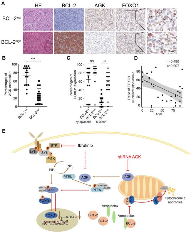 AGK Antibody in Immunohistochemistry (IHC)