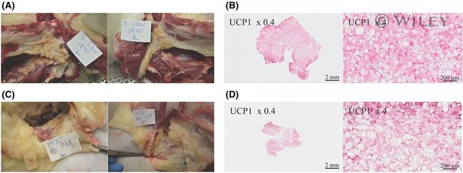 UCP1 Antibody in Immunohistochemistry (IHC)