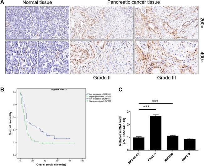 ZNF655 Antibody in Immunohistochemistry (IHC)