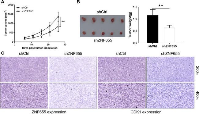 ZNF655 Antibody in Immunohistochemistry (IHC)