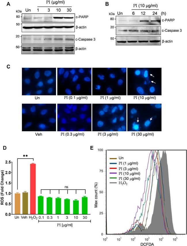 PARP1 (cleaved Asp214, Asp215) Antibody in Western Blot (WB)