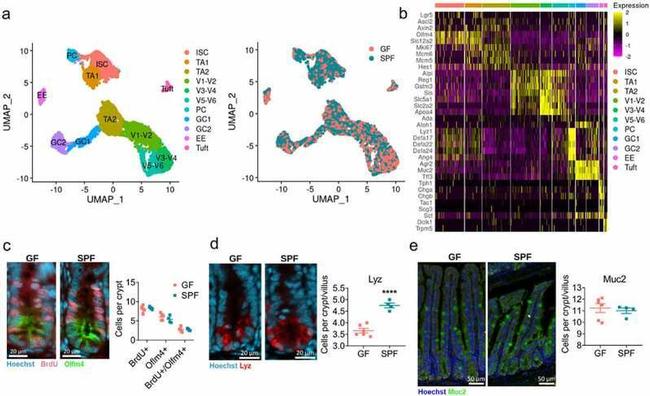 MUC2 Antibody in Immunohistochemistry (IHC)