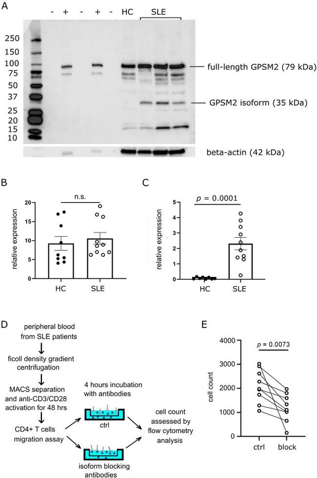 GPSM2 Antibody in Western Blot (WB)