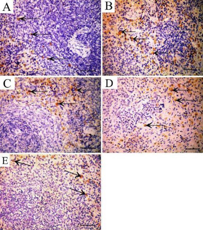 S100A9 Antibody in Immunohistochemistry (IHC)