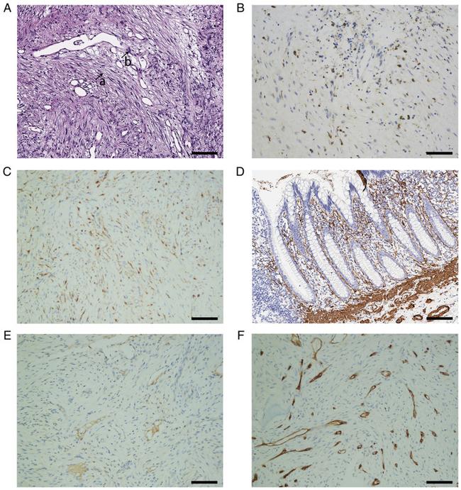 CD68 Antibody in Immunohistochemistry (Paraffin) (IHC (P))