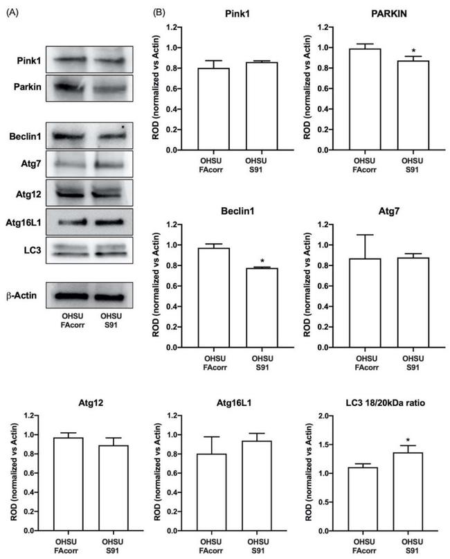 Parkin Antibody in Western Blot (WB)