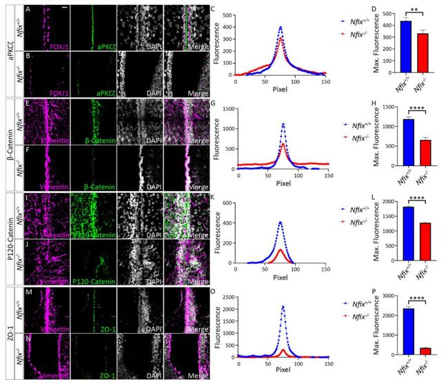 ZO-1 Antibody in Immunohistochemistry (IHC)