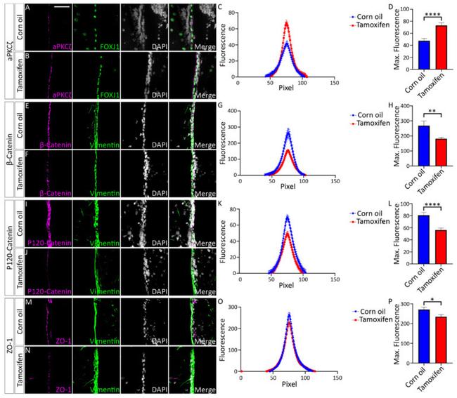 ZO-1 Antibody in Immunohistochemistry (IHC)