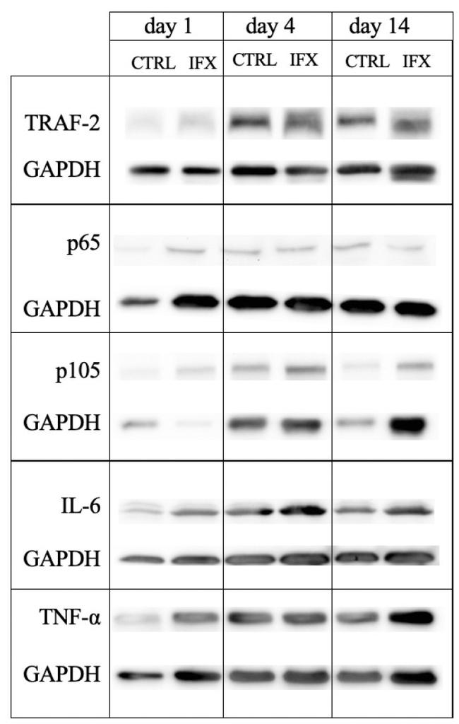 NFkB p50/p105 Antibody in Western Blot (WB)