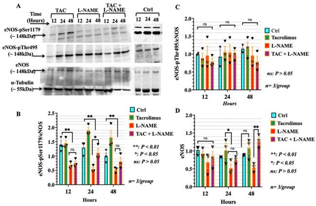 Phospho-eNOS (Ser1179) Antibody in Western Blot (WB)