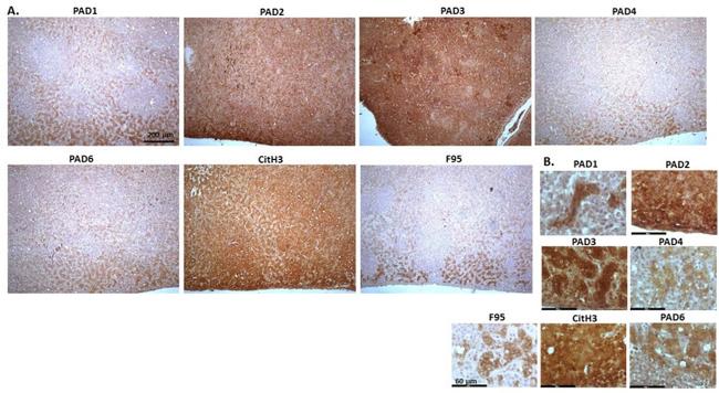 PADI6 Antibody in Immunohistochemistry (IHC)