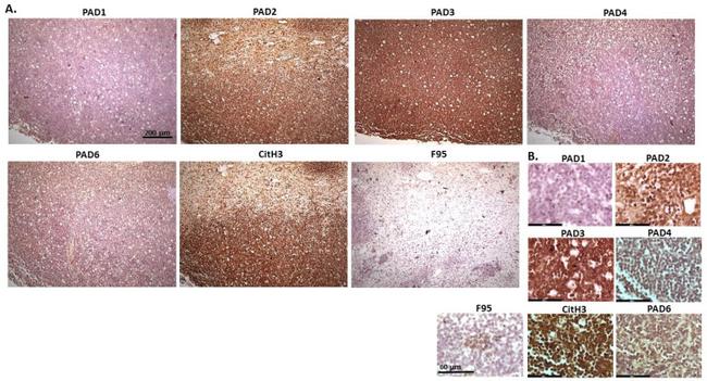 PADI6 Antibody in Immunohistochemistry (IHC)