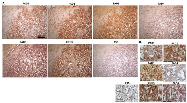 PADI6 Antibody in Immunohistochemistry (IHC)