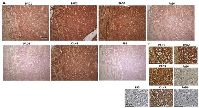 PADI6 Antibody in Immunohistochemistry (IHC)