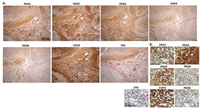 PADI6 Antibody in Immunohistochemistry (IHC)