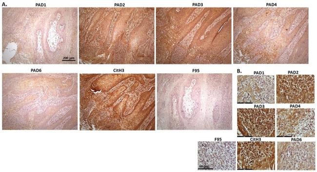 PADI6 Antibody in Immunohistochemistry (IHC)