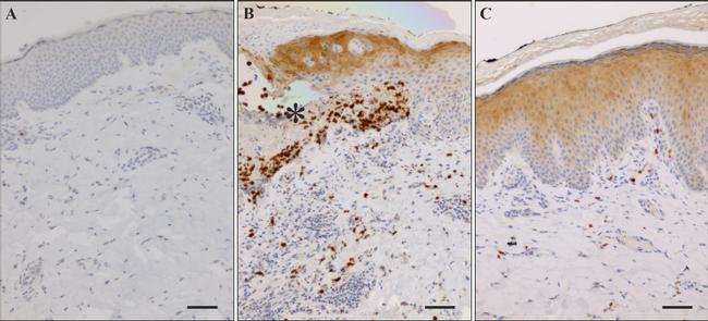 SDF1 Antibody in Immunohistochemistry (IHC)