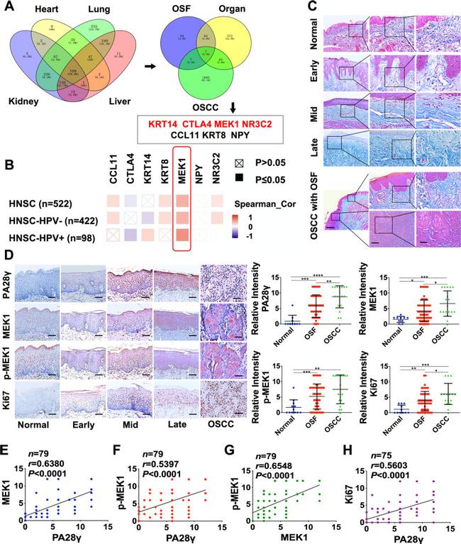 PSME3 Antibody in Immunohistochemistry (IHC)