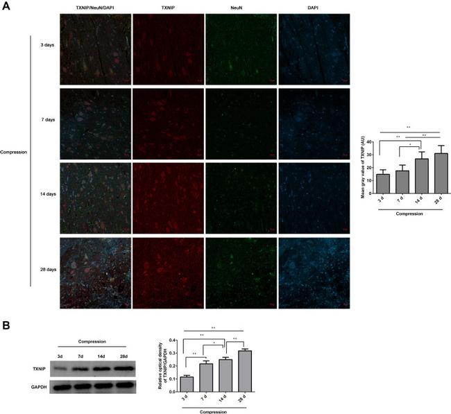 TXNIP Antibody in Western Blot, Immunohistochemistry (WB, IHC)