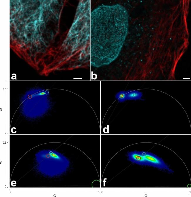 Vimentin Antibody in Immunocytochemistry (ICC/IF)