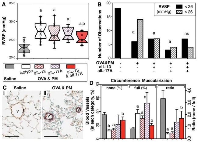 IL-13 Antibody in Neutralization (Neu)