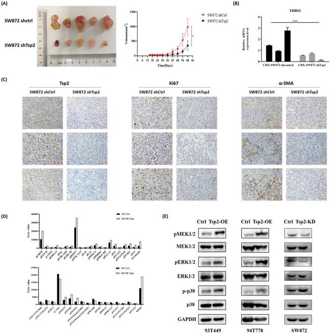 Thrombospondin 2 Antibody in Immunohistochemistry (IHC)