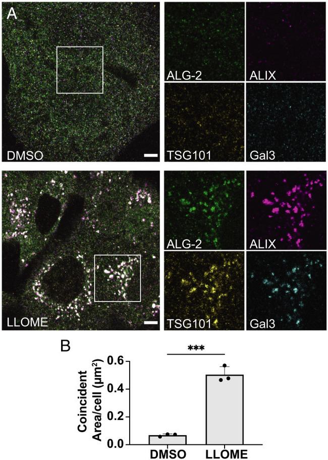 Alix Antibody in Immunocytochemistry (ICC/IF)