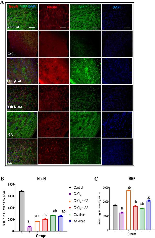 MBP Antibody in Immunohistochemistry (IHC)