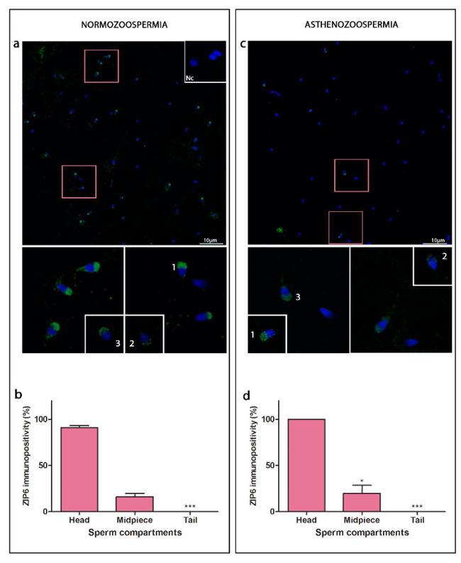 SLC39A6 Antibody in Immunocytochemistry (ICC/IF)