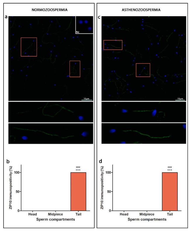 ZIP10 Antibody in Immunocytochemistry (ICC/IF)