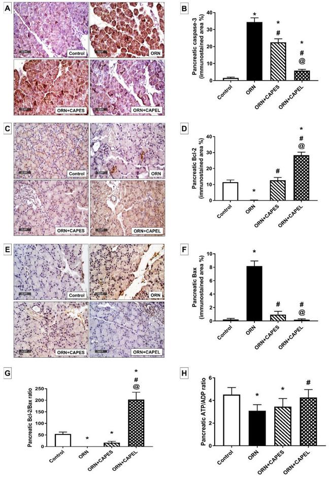 Bcl-2 Antibody in Immunohistochemistry (IHC)